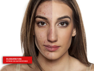 Bildbearbeitung und Retusche von Hautunreinheiten