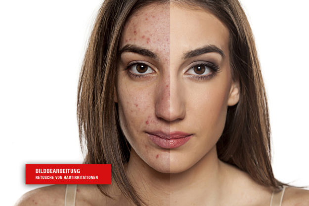 Bildbearbeitung und Retusche von Hautunreinheiten
